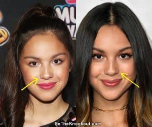 did olivia rodrigo get breast implants|Olivia Rodrigo Plastic Surgery: Boob Job and Lip。